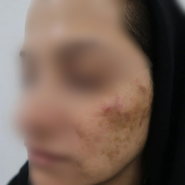 image1-1-768x768-(1)